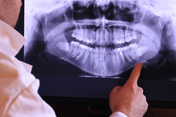 Best Chipped Tooth Repair Near Me  in Woodworth, OH