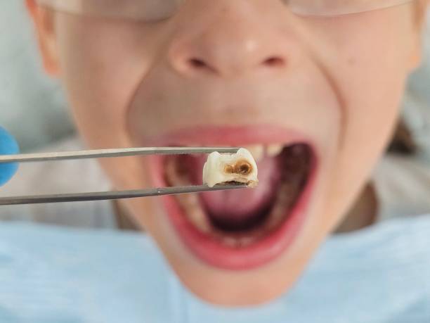 Best Emergency Pediatric Dentist  in Woodworth, OH