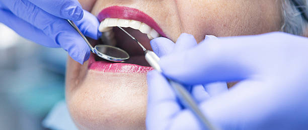 Best Dentist for Tooth Abscess  in Woodworth, OH