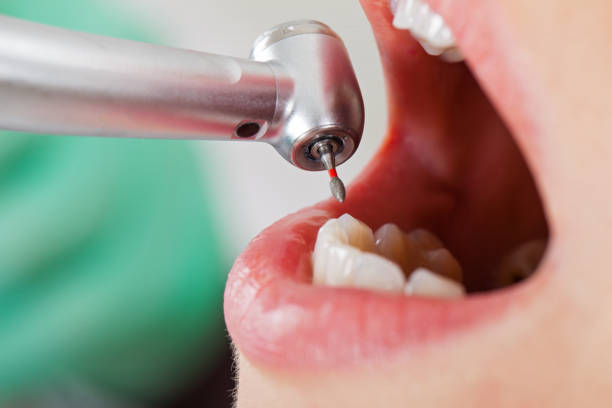 Best Urgent Dental Care  in Woodworth, OH